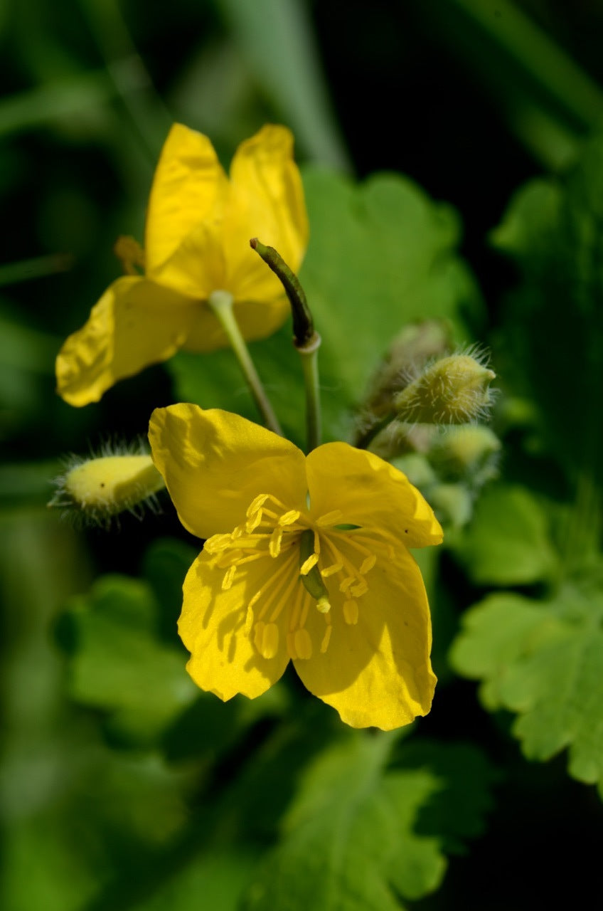 Liver and Gallbladder (WS)